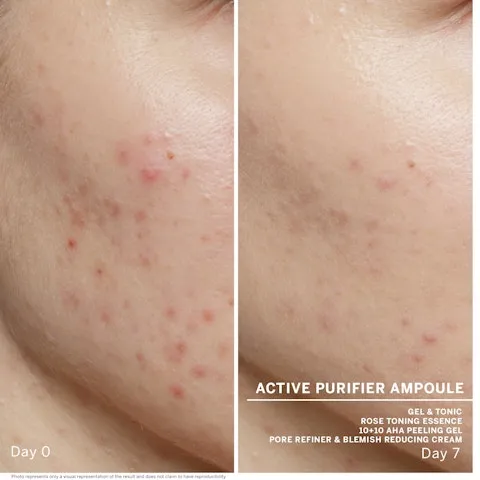 Active Purifier